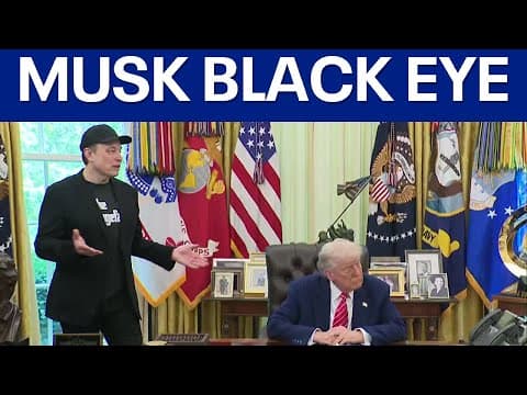 Elon Musk zeigt blaues Auge nach spielerischem Sparring mit Sohn X Æ A-Xii im Oval Office